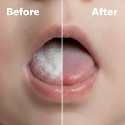 Baby Oral Cleaning Gauze Sticks